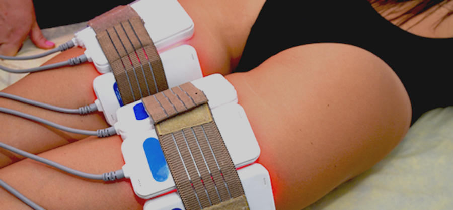 Lipo Cavitation Treatment (RF)