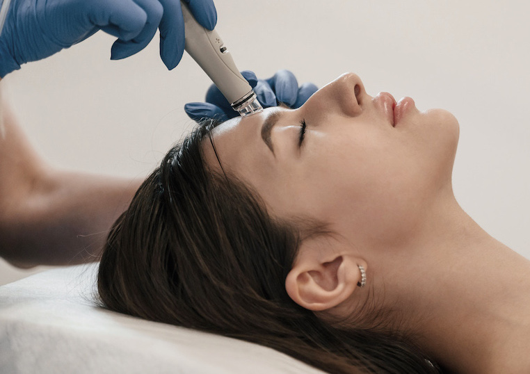 Micro-Needling