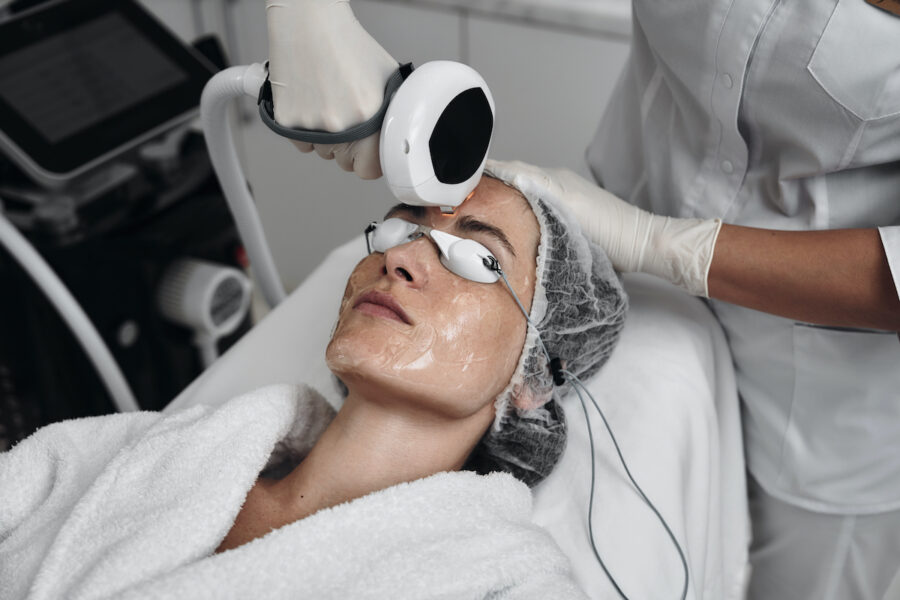Laser Hair Removal