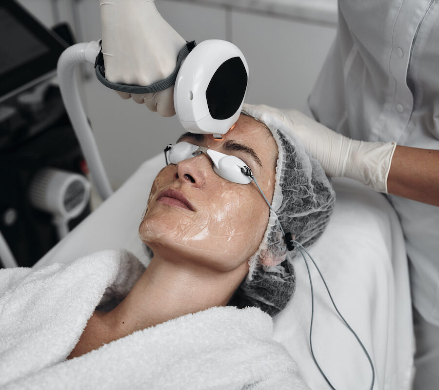 Laser Hair Removal