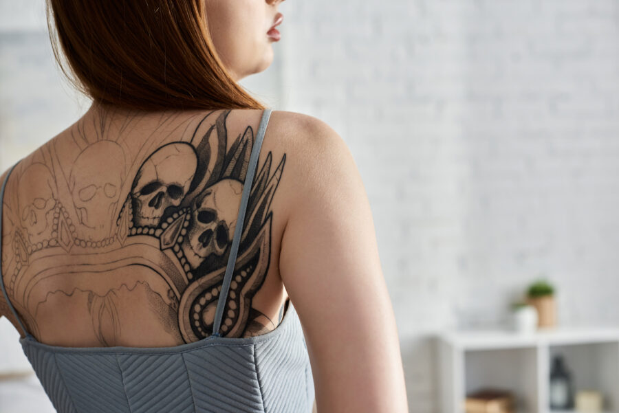 Laser Tattoo Removal